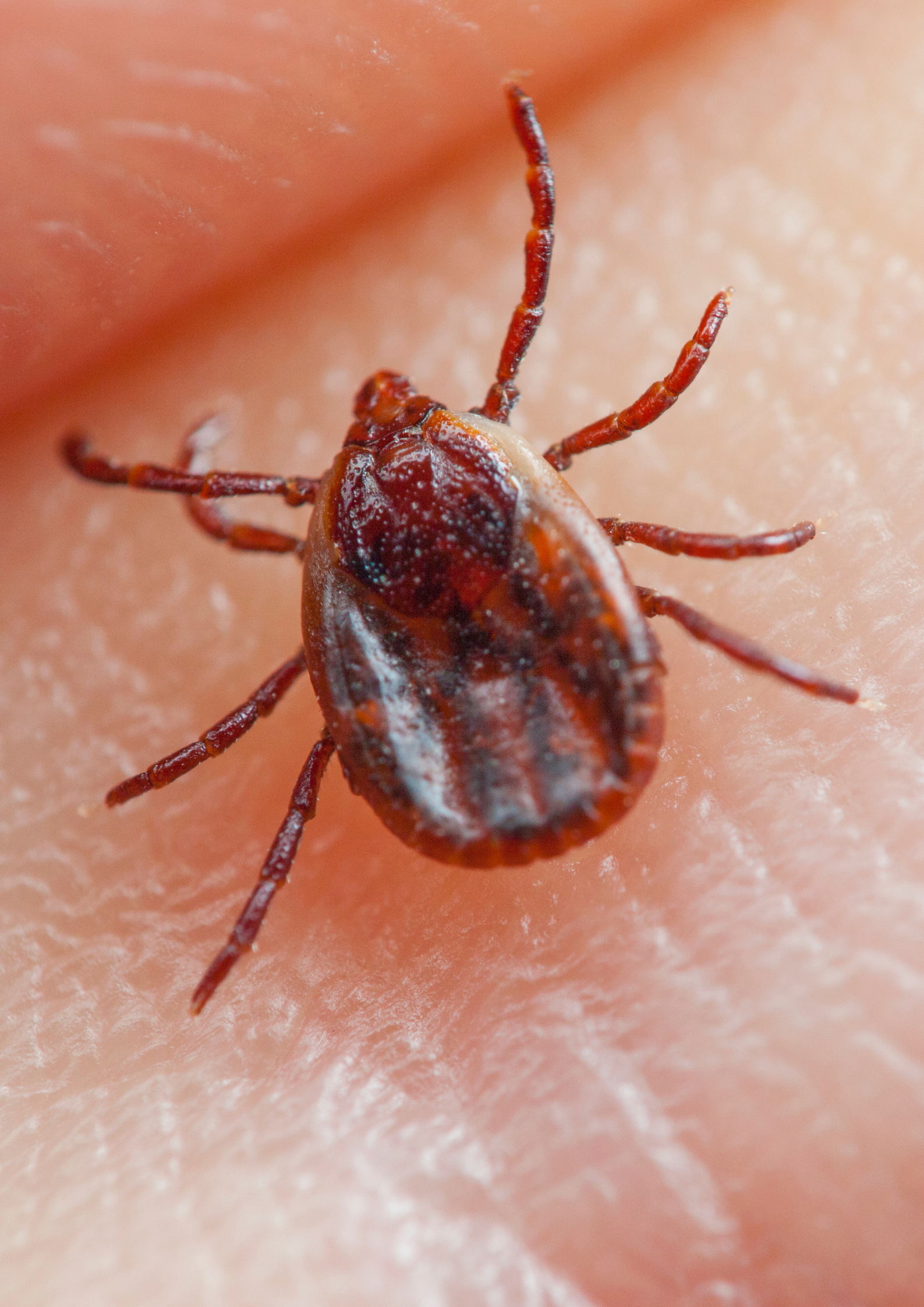 Close up image of a tick shown in detail for removal of a tick concept